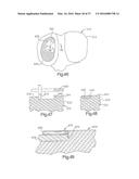 METHOD FOR PLACING IMPLANT USING ROBOTIC SYSTEM diagram and image