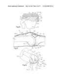 METHOD FOR PLACING IMPLANT USING ROBOTIC SYSTEM diagram and image