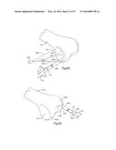 METHOD FOR PLACING IMPLANT USING ROBOTIC SYSTEM diagram and image