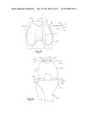 METHOD FOR PLACING IMPLANT USING ROBOTIC SYSTEM diagram and image