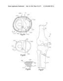 METHOD FOR PLACING IMPLANT USING ROBOTIC SYSTEM diagram and image