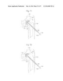 METHOD FOR PLACING IMPLANT USING ROBOTIC SYSTEM diagram and image