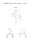 METHOD FOR PLACING IMPLANT USING ROBOTIC SYSTEM diagram and image