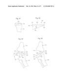 METHOD FOR PLACING IMPLANT USING ROBOTIC SYSTEM diagram and image