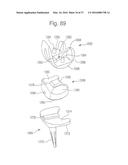 METHOD FOR PLACING IMPLANT USING ROBOTIC SYSTEM diagram and image