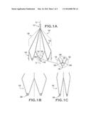 IVC Filter with Translating Hooks diagram and image