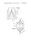 IVC Filter with Translating Hooks diagram and image