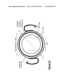 INDUCTIVE COIL SENSOR FOR VISION CORRECTIVE APPARATUS AND METHODS THEREFOR diagram and image