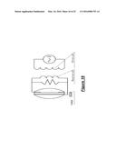 INDUCTIVE COIL SENSOR FOR VISION CORRECTIVE APPARATUS AND METHODS THEREFOR diagram and image