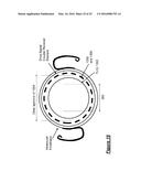 INDUCTIVE COIL SENSOR FOR VISION CORRECTIVE APPARATUS AND METHODS THEREFOR diagram and image