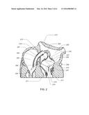 MEDICAL DEVICE, KIT AND METHOD FOR CONSTRICTING TISSUE OR A BODILY     ORIFICE, FOR EXAMPLE, A MITRAL VALVE diagram and image