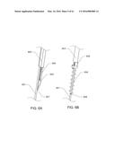 MEDICAL DEVICE, KIT AND METHOD FOR CONSTRICTING TISSUE OR A BODILY     ORIFICE, FOR EXAMPLE, A MITRAL VALVE diagram and image