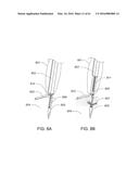 MEDICAL DEVICE, KIT AND METHOD FOR CONSTRICTING TISSUE OR A BODILY     ORIFICE, FOR EXAMPLE, A MITRAL VALVE diagram and image