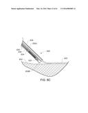 MEDICAL DEVICE, KIT AND METHOD FOR CONSTRICTING TISSUE OR A BODILY     ORIFICE, FOR EXAMPLE, A MITRAL VALVE diagram and image