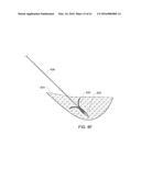 MEDICAL DEVICE, KIT AND METHOD FOR CONSTRICTING TISSUE OR A BODILY     ORIFICE, FOR EXAMPLE, A MITRAL VALVE diagram and image