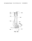 MEDICAL DEVICE, KIT AND METHOD FOR CONSTRICTING TISSUE OR A BODILY     ORIFICE, FOR EXAMPLE, A MITRAL VALVE diagram and image