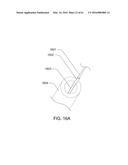 MEDICAL DEVICE, KIT AND METHOD FOR CONSTRICTING TISSUE OR A BODILY     ORIFICE, FOR EXAMPLE, A MITRAL VALVE diagram and image