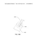 MEDICAL DEVICE, KIT AND METHOD FOR CONSTRICTING TISSUE OR A BODILY     ORIFICE, FOR EXAMPLE, A MITRAL VALVE diagram and image