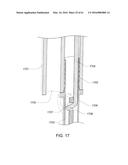 MEDICAL DEVICE, KIT AND METHOD FOR CONSTRICTING TISSUE OR A BODILY     ORIFICE, FOR EXAMPLE, A MITRAL VALVE diagram and image