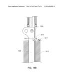 MEDICAL DEVICE, KIT AND METHOD FOR CONSTRICTING TISSUE OR A BODILY     ORIFICE, FOR EXAMPLE, A MITRAL VALVE diagram and image