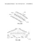 MEDICAL DEVICE, KIT AND METHOD FOR CONSTRICTING TISSUE OR A BODILY     ORIFICE, FOR EXAMPLE, A MITRAL VALVE diagram and image