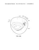 MEDICAL DEVICE, KIT AND METHOD FOR CONSTRICTING TISSUE OR A BODILY     ORIFICE, FOR EXAMPLE, A MITRAL VALVE diagram and image