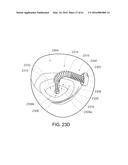 MEDICAL DEVICE, KIT AND METHOD FOR CONSTRICTING TISSUE OR A BODILY     ORIFICE, FOR EXAMPLE, A MITRAL VALVE diagram and image