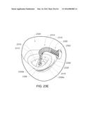 MEDICAL DEVICE, KIT AND METHOD FOR CONSTRICTING TISSUE OR A BODILY     ORIFICE, FOR EXAMPLE, A MITRAL VALVE diagram and image