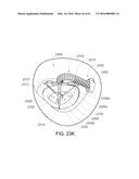 MEDICAL DEVICE, KIT AND METHOD FOR CONSTRICTING TISSUE OR A BODILY     ORIFICE, FOR EXAMPLE, A MITRAL VALVE diagram and image