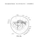 MEDICAL DEVICE, KIT AND METHOD FOR CONSTRICTING TISSUE OR A BODILY     ORIFICE, FOR EXAMPLE, A MITRAL VALVE diagram and image