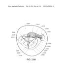 MEDICAL DEVICE, KIT AND METHOD FOR CONSTRICTING TISSUE OR A BODILY     ORIFICE, FOR EXAMPLE, A MITRAL VALVE diagram and image