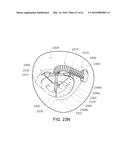 MEDICAL DEVICE, KIT AND METHOD FOR CONSTRICTING TISSUE OR A BODILY     ORIFICE, FOR EXAMPLE, A MITRAL VALVE diagram and image