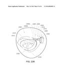 MEDICAL DEVICE, KIT AND METHOD FOR CONSTRICTING TISSUE OR A BODILY     ORIFICE, FOR EXAMPLE, A MITRAL VALVE diagram and image