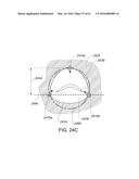 MEDICAL DEVICE, KIT AND METHOD FOR CONSTRICTING TISSUE OR A BODILY     ORIFICE, FOR EXAMPLE, A MITRAL VALVE diagram and image