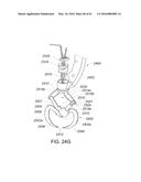 MEDICAL DEVICE, KIT AND METHOD FOR CONSTRICTING TISSUE OR A BODILY     ORIFICE, FOR EXAMPLE, A MITRAL VALVE diagram and image