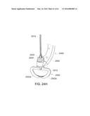 MEDICAL DEVICE, KIT AND METHOD FOR CONSTRICTING TISSUE OR A BODILY     ORIFICE, FOR EXAMPLE, A MITRAL VALVE diagram and image