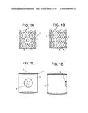 Aspirating Implants and Method of Bony Regeneration diagram and image