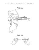 Aspirating Implants and Method of Bony Regeneration diagram and image