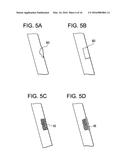 Aspirating Implants and Method of Bony Regeneration diagram and image