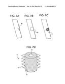 Aspirating Implants and Method of Bony Regeneration diagram and image