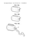 Aspirating Implants and Method of Bony Regeneration diagram and image