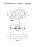 DISTRACTIBLE INTERVERTEBRAL IMPLANT diagram and image