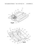 DISTRACTIBLE INTERVERTEBRAL IMPLANT diagram and image