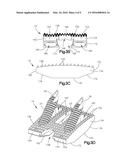 DISTRACTIBLE INTERVERTEBRAL IMPLANT diagram and image