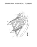 DISTRACTIBLE INTERVERTEBRAL IMPLANT diagram and image