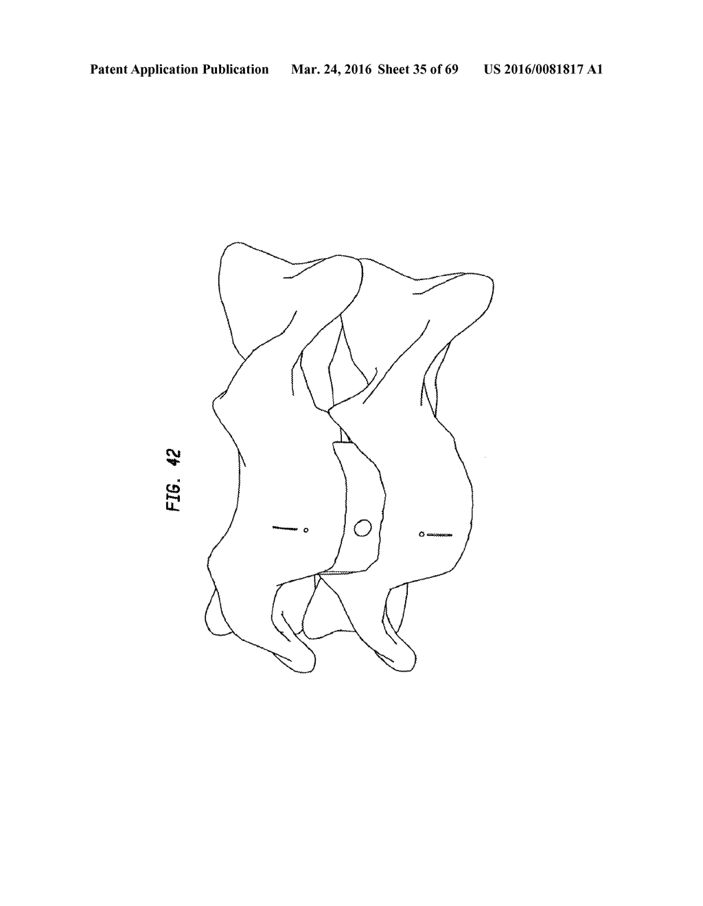 INTERVERTEBRAL DISC AND INSERTION METHODS THEREFOR - diagram, schematic, and image 36