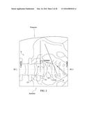 SPINAL IMPLANT SYSTEM AND METHOD FOR LUMBAR AND LUMBOSACRAL FUSION diagram and image