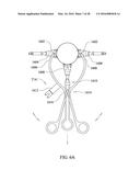 SPINAL IMPLANT SYSTEM AND METHOD FOR LUMBAR AND LUMBOSACRAL FUSION diagram and image