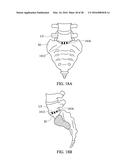 SPINAL IMPLANT SYSTEM AND METHOD FOR LUMBAR AND LUMBOSACRAL FUSION diagram and image