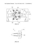 SPINAL IMPLANT SYSTEM AND METHOD FOR LUMBAR AND LUMBOSACRAL FUSION diagram and image